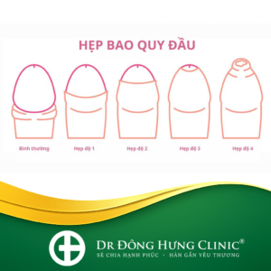 bao quy đầu