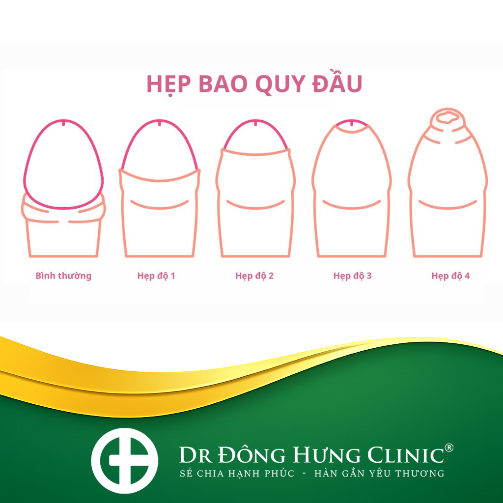 bao quy đầu